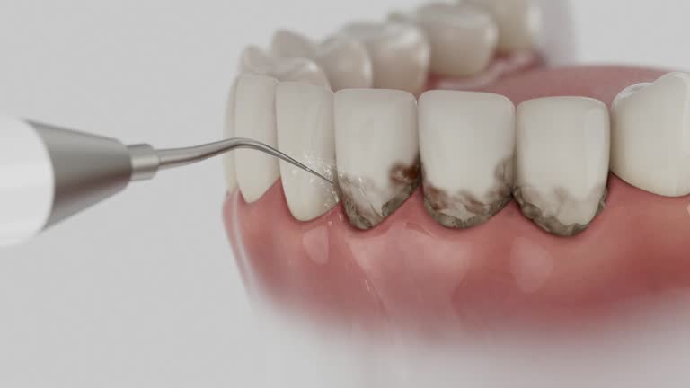 Trusted Teeth Cleaning And Checkup service in Marengo, IL - Dentist Open Now